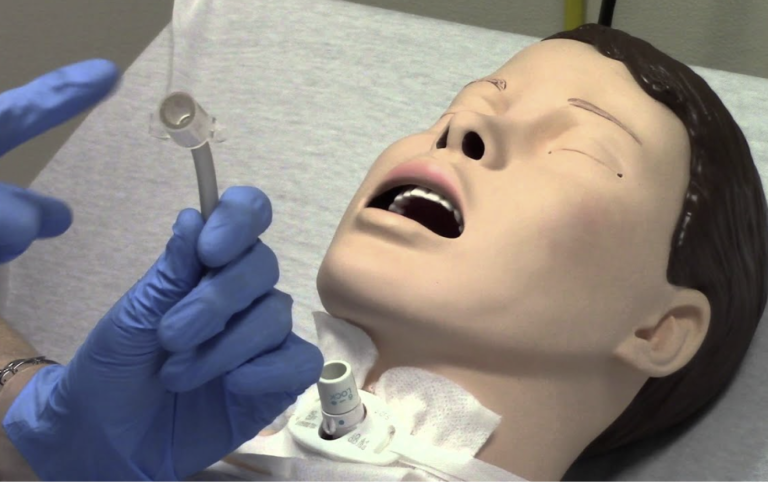 Tracheostomy